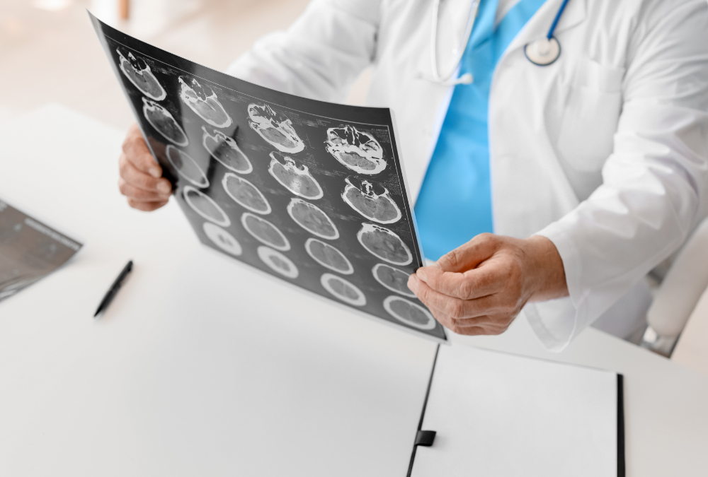 Why are Mild Traumatic Brain Injuries Often Missed?