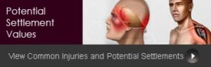 New Resource! Personal Injury Potential Settlement Values